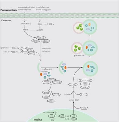 An Autophagy-Related Gene Signature can Better Predict Prognosis and Resistance in Diffuse Large B-Cell Lymphoma